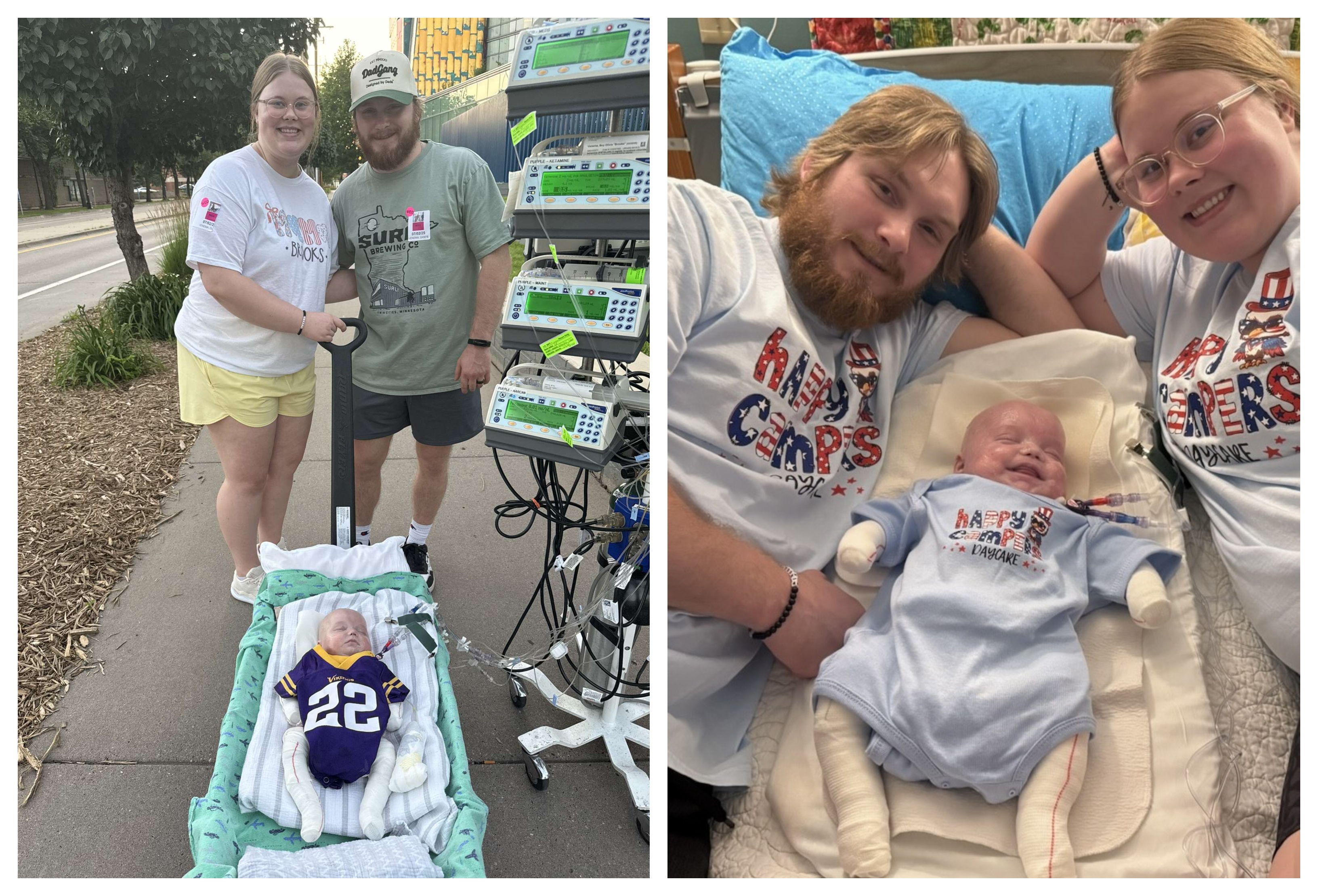 Epidermolysis Bullosa Personal Story