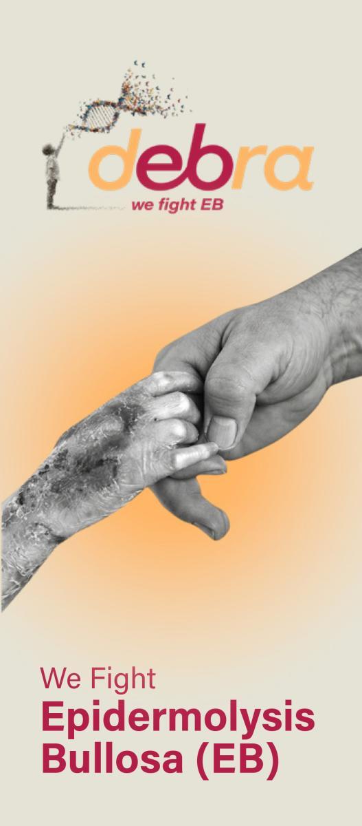 Epidermolysis Bullosa Information